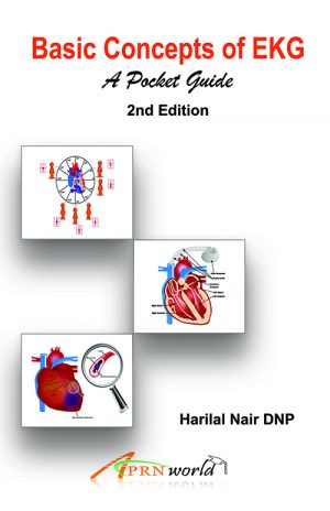 EKG