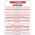 12 lead EKG Pocket Card - APRN world