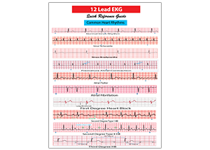 Ekg-card-revised-1 - Aprn World