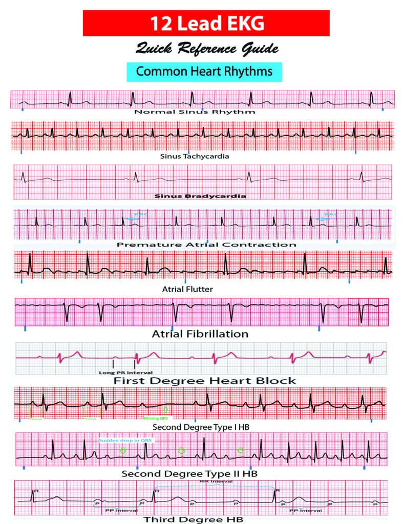 EKG-card-revised-1 - APRN world