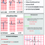 12 lead EKG Pocket Card - APRN world